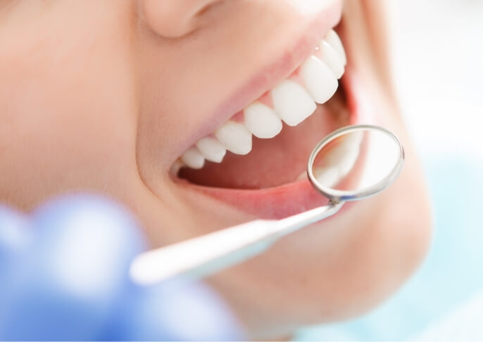 虫歯と治療を繰り返す危険性